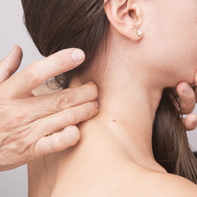 cervical dystonia cervical dystonia