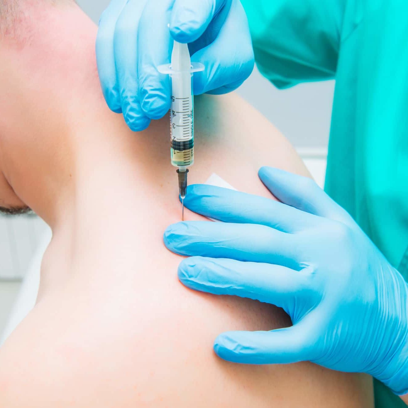Close up Neurologist doctor makes an injection therapy (blockade) into trapezium muscle of male patient. Alternative pain treatment concept. Selective focus, space for text. Close up Neurologist doctor makes an injection therapy (blockade) into trapezium muscle of male patient. Alternative pain treatment concept. Selective focus,